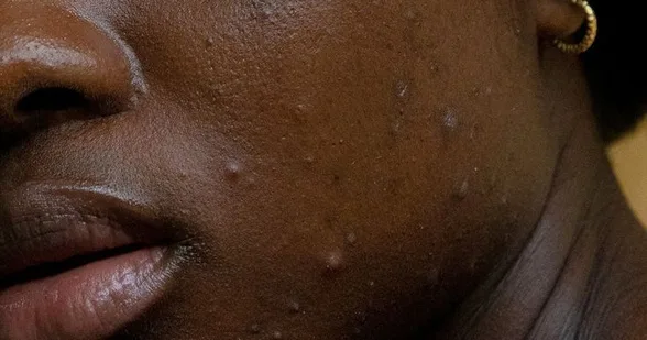 Intricate facial pore texture and dermal analysis